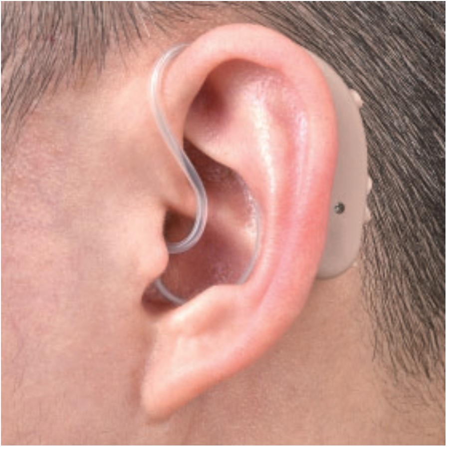 proimages/UP6ER7_Hearing_aid/UP-6ER7e.jpg proimages/UP6ER7_Hearing_aid/UP-6ER7e.jpg